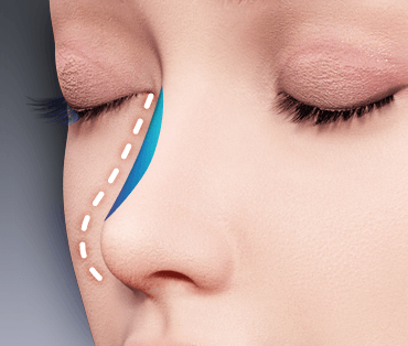 鼻を整える方法は？