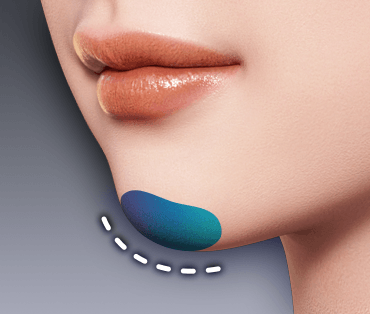 アゴを整える方法は？