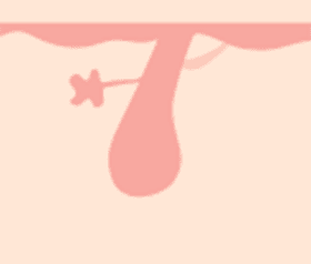 毛は生えてこない