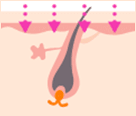 照射は毛根まで届かない