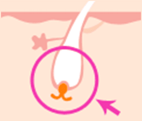 毛を生やす組織は残る