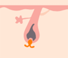 また毛が生えてくる