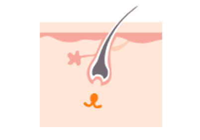 毛乳頭から毛根が離れるため毛が抜けやすい時期