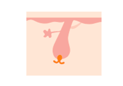 毛乳頭が次のサイクルまで休んでいる時期