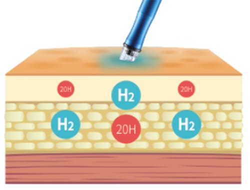 素水ケア&オゾン水殺菌【画像】