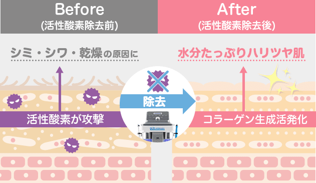 コラーゲン増生で老けさせない！水素が活性酵素を取り除く【画像】