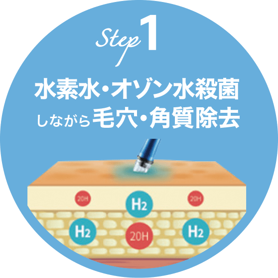 STEP1 水素水・オゾン水殺菌しながら毛穴・角質除去【画像】