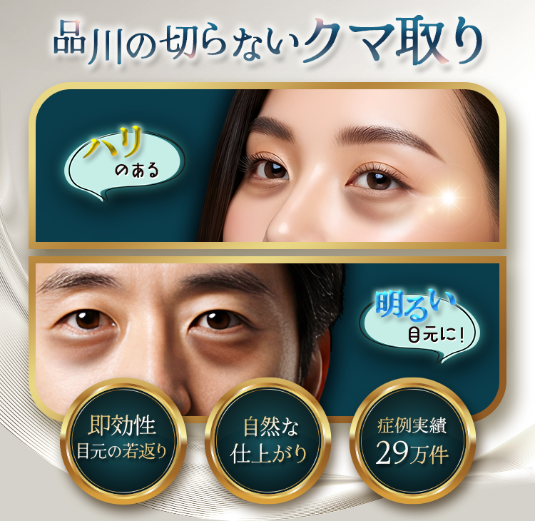 メスを使用しない品川のクマ取りで若々しい目周りに！ 即実感できる目元のエイジングケア　ナチュラルな仕上がり　29万症例！