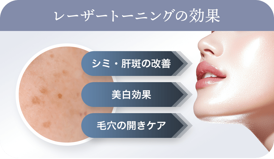 レーザートーニングの作用 シミや肝斑を薄く 透明感アップ 毛穴の引き締め