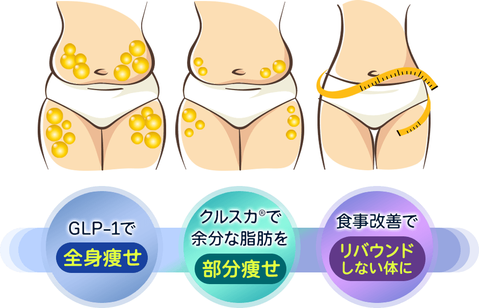 全身痩せたいならGLP-1 部分的に痩せたいならクールスカルプティング&reg; 管理栄養士のアドバイスでリバウンドを阻止