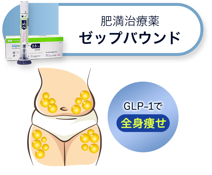 肥満治療薬ゼップバウンド 全身痩せたいならGLP-1