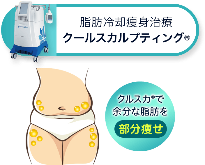 脂肪冷却痩身治療 クールスカルプティング&reg; 部分的に痩せたいならクールスカルプティング&reg;
