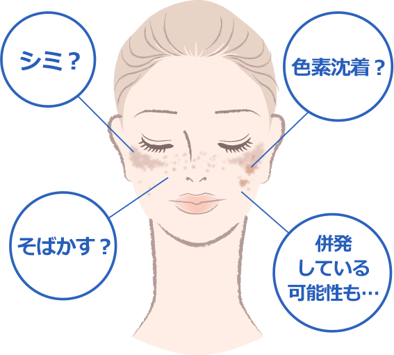 シミ？ 色素沈着？ そばかす？ 併発している可能性も