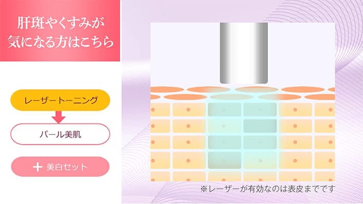 肝斑やくすみが気になる方はこちら。コラーゲンピール・レーザートーニング・パール美肌・+美白セット。※レーザーが有効なのは表皮までです。