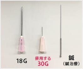 極細の針で、治療の痛みは最小限に