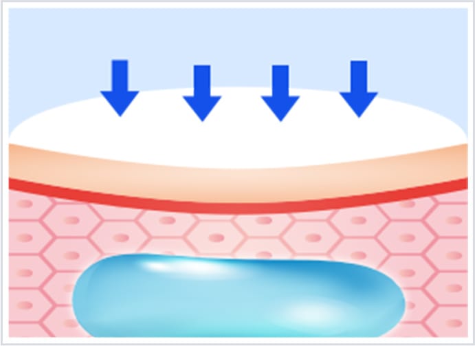 外力による圧力で変形しやすい【画像】
