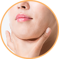 エラ張り・ベース顔【画像】