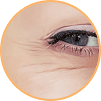 目元・眉間・額などの表情ジワ【画像】