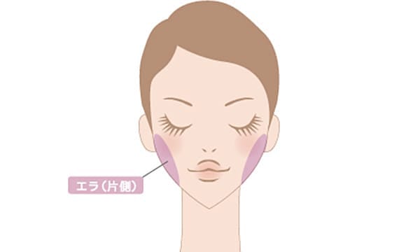 ボツリヌス・トキシン注入による治療部位【画像】