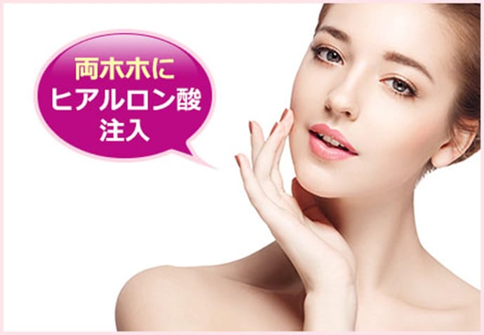 両ホホにヒアルロン酸注入