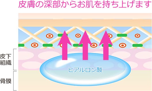 皮膚の深部からお肌を持ち上げます