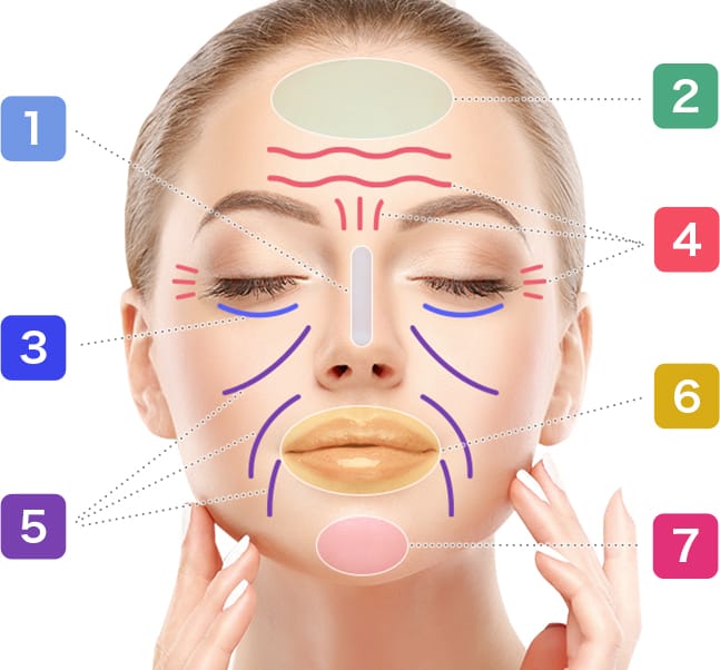 注入部位一覧【画像】