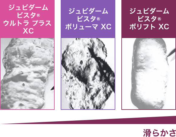 ジュビダームビスタ&reg;ウルトラプラスXC ジュビダームビスタ&reg;ボリューマXC ジュビダームビスタ&reg;ボリフトXC 滑らかさ