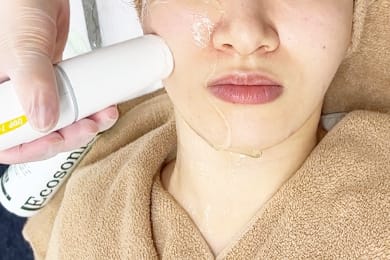 治療を行います【画像】