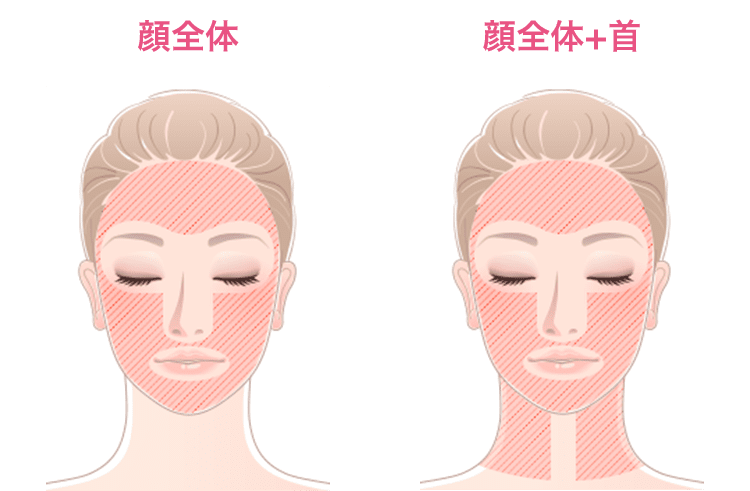 3D HIFUの料金は対象部位によって異なります
