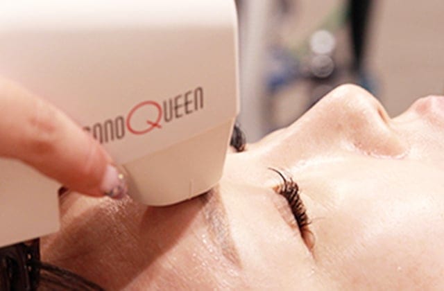 目のまわりの小じわなど比較的浅い層にも照射できます【画像】