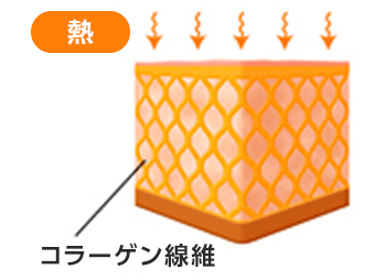 コラーゲン繊維に熱を与える【画像】