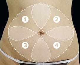 クールスカルプティング&reg;：脂肪を冷却して破壊する痩身術。治療部位5【画像】