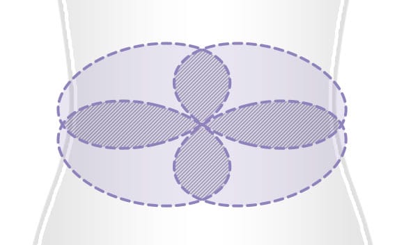 脂肪が多い場所は重ねて施術効果を高めます【画像】