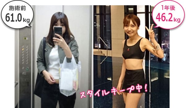 モニター 施術前/1年後