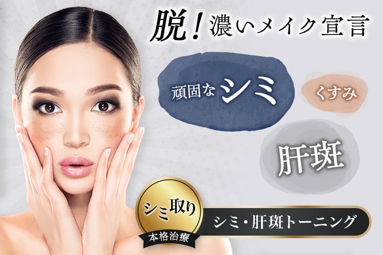 脱！濃いメイク宣言 頑固なシミ・肝斑・くすみ シミ取り本格治療 しみ・肝斑トーニング