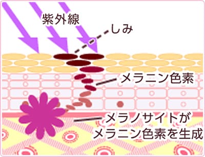 紫外線、しみ、メラニン色素、メラノサイトがメラニン色素を生成【画像】