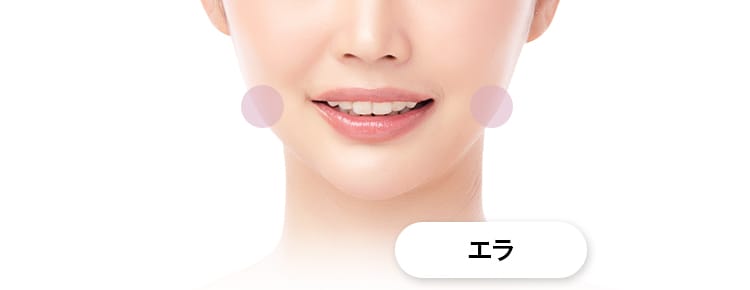 【アラガン社ボトックス注射】プチ小顔処置部位：エラ【画像】