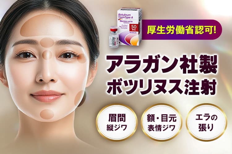 厚生労働省認可！アラガン社製ボトックス注射 眉間縦ジワ/額・目元表情ジワ/エラの張り