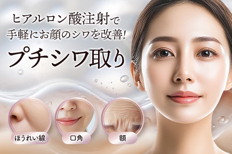 ヒアルロン酸注射で手軽にお顔のシワを改善！プチシワ取り ほうれい線・口角・額