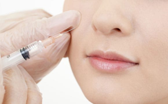 ヒアルロン酸注入「プチシワ取り」【画像】
