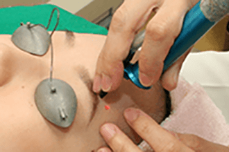 レーザーを当てていきます【画像】