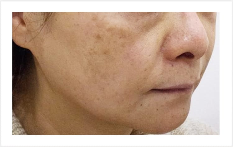 青ぐすみ【画像】