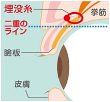 二点留めの説明画像2【画像】