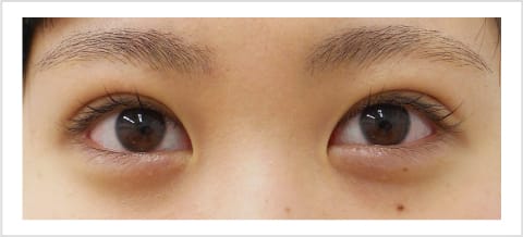 末広型【画像】