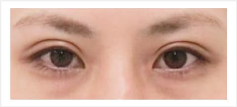 平行型【画像】