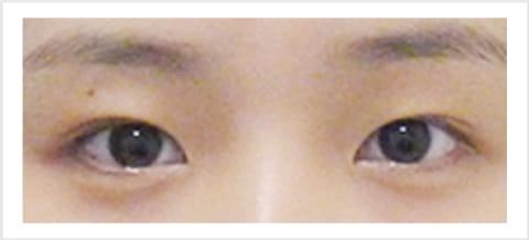 奥二重【画像】