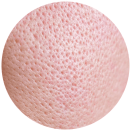 毛穴の開いた状態【画像】