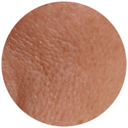 たるみ毛穴【画像】