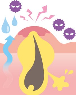 敏感肌【画像】