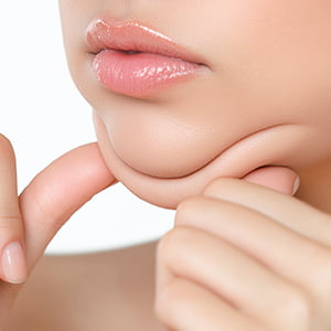 梅田院の小顔治療